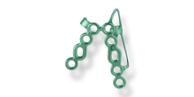 Catching Condyle Platte links