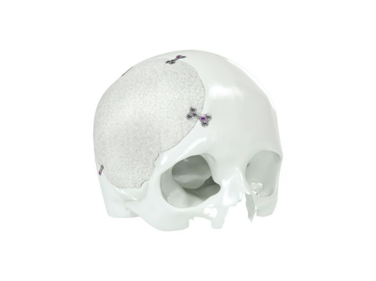 Individual Patient Solutions