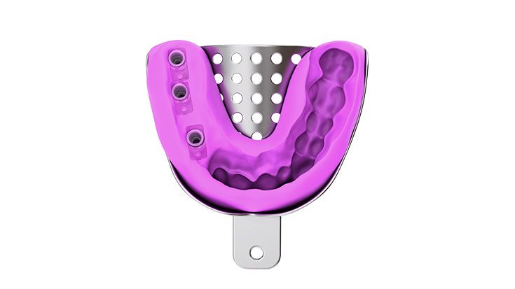 Geschlossene Abdrucknahme