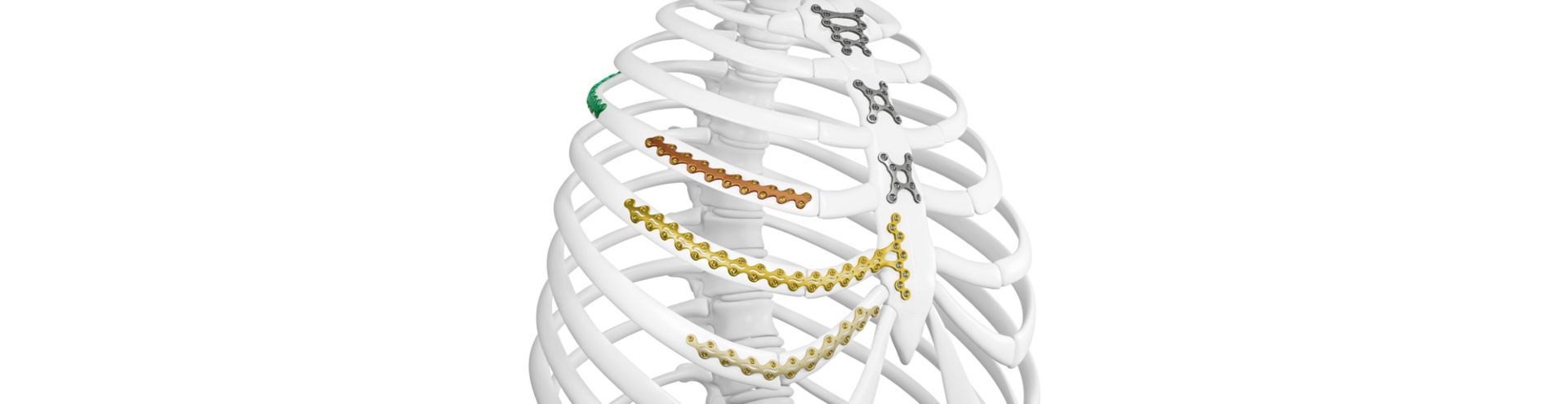 Kopfbild L1® Rib