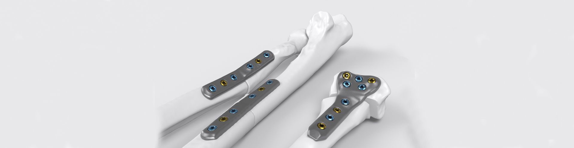 Header IPS Implants® Forearm Reconstruction