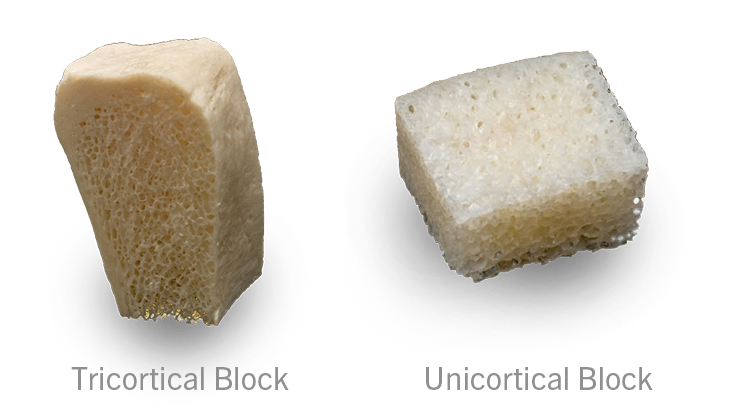 Traditional Allografts