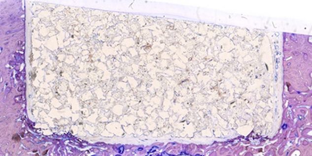 Postoperatorio, después de 3 meses