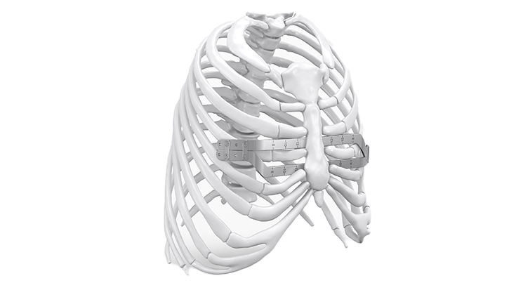 Implants | Reconstruction