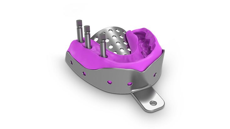 Einstecken der Analogpfosten