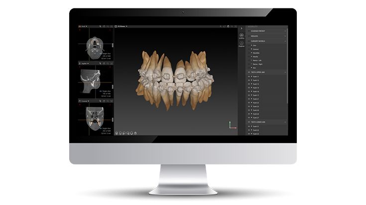 Tooth root segmentation and mandibular nerve creation