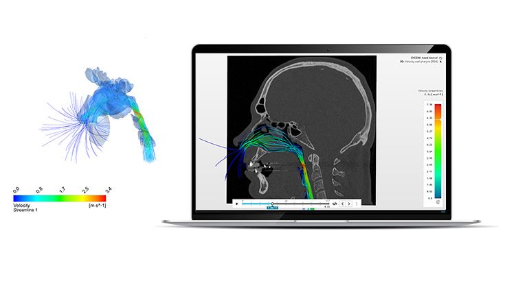 IPS inSilico® x OSA 