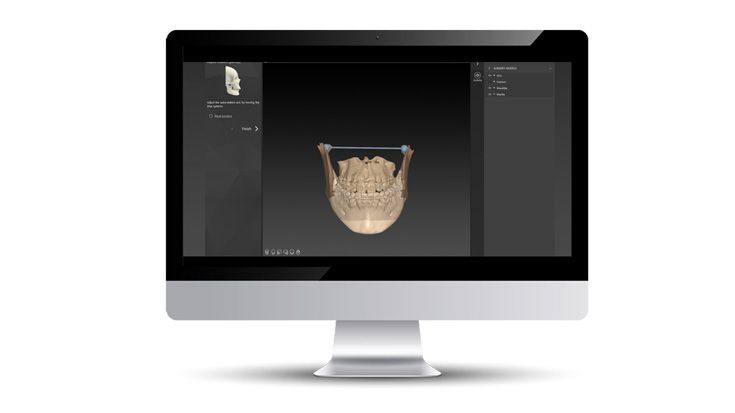 Autorotationsachse und Rami-Rotationspunkte