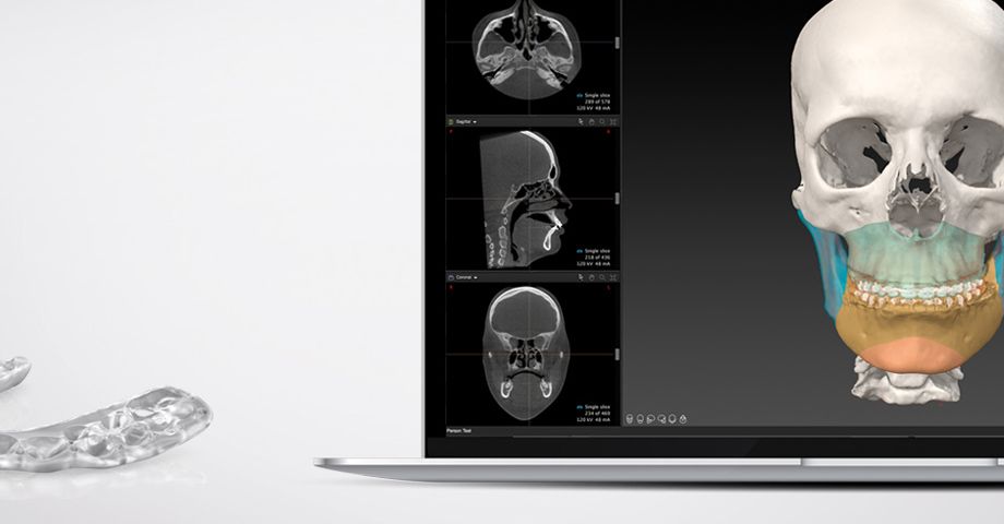 Individual Patient Solutions - IPS CaseDesigner®