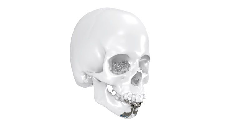 Transversal plane of the maxilla and mandible