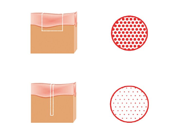 Fraktioniertes Scannen