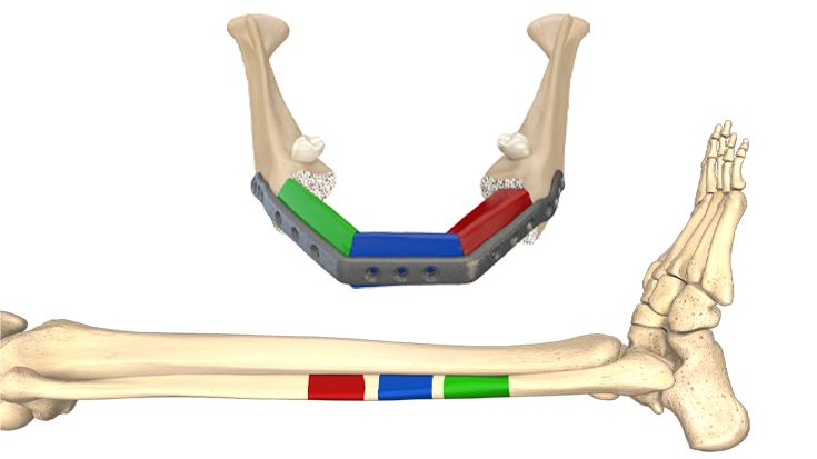 1. Vorab: Virtuelle Planung