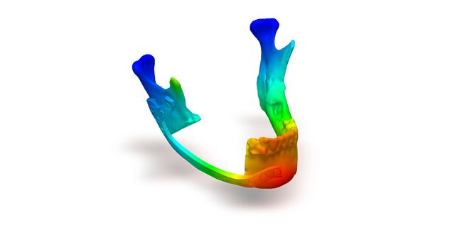 IPS inSilico® x VIT mandible