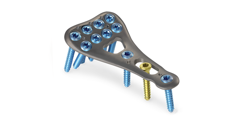Implants | Forearm