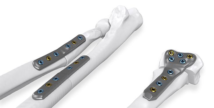 Individual Patient Solutions