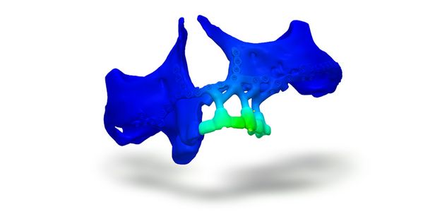 IPS inSilico® x VIT maxilla