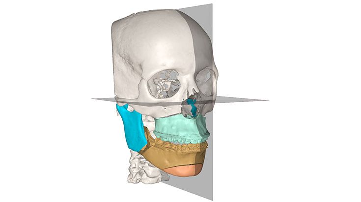 Porno siyish ogiz Porno oz xotinini olomonga karta oyinida yoqotdi