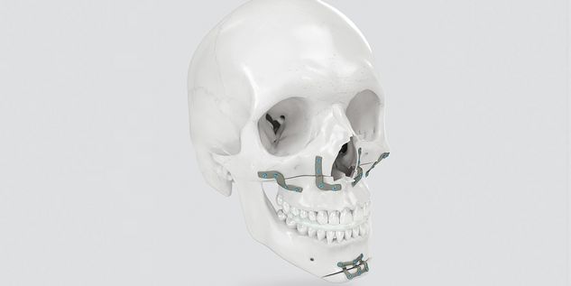 Individual Patient Solutions (IPS®)