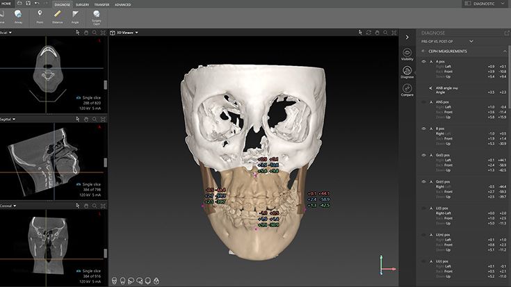 Comparison of two data sets