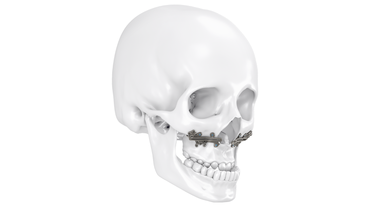 Drill and marking guides