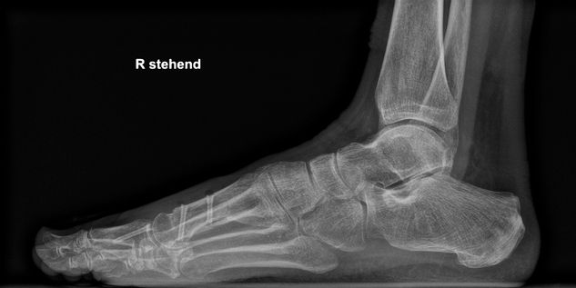 6 Wochen postoperativ