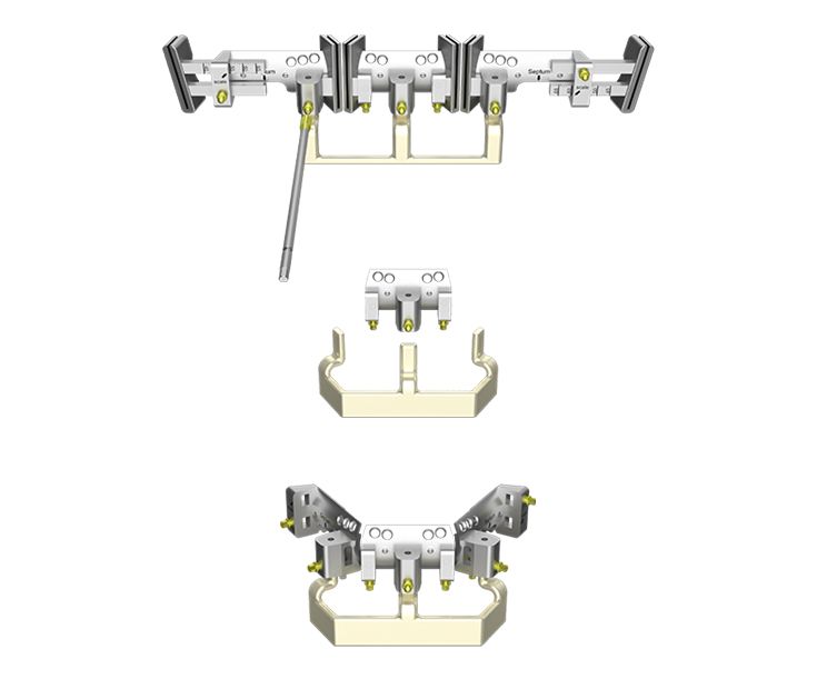 Sägeschablone für Fibularekonstruktion
