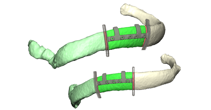 Drill and marking guides
