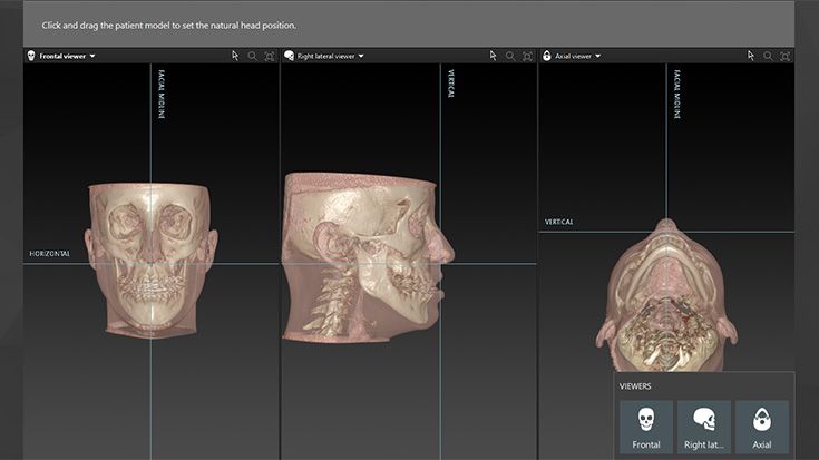 Axial view for positioning the patient dataset