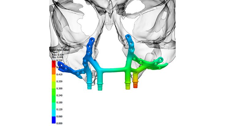 IPS inSilico® x VIT 