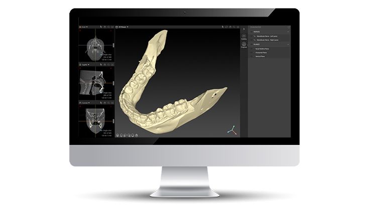 Watertight and closed models