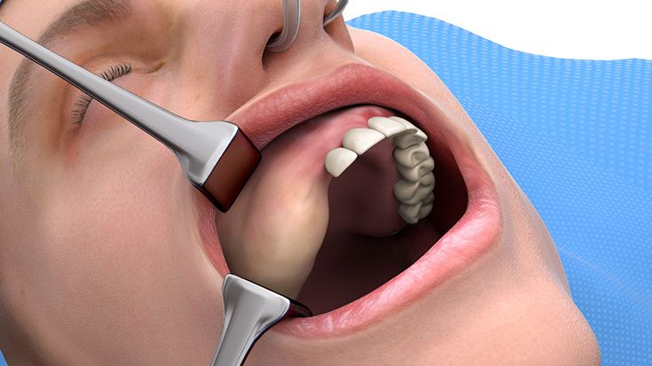 2. Präoperative Darstellung