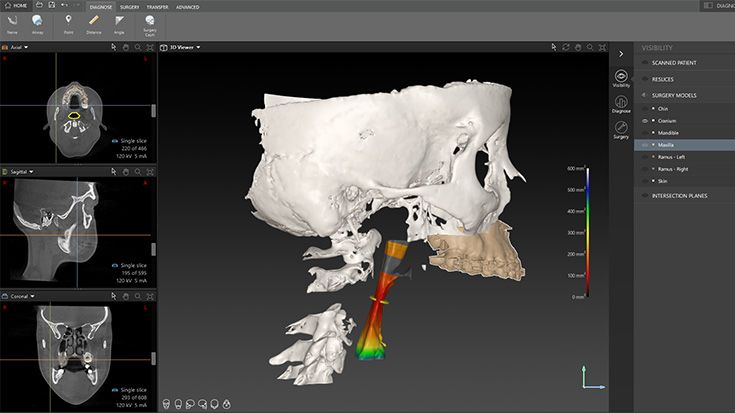 Airway analysis 