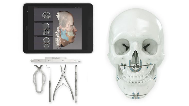 L1® MI Orthognathics