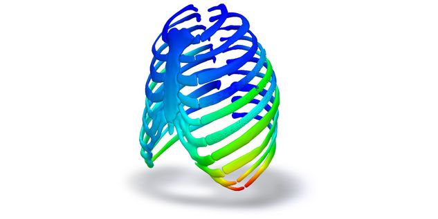 IPS inSilico® x VIT thorax