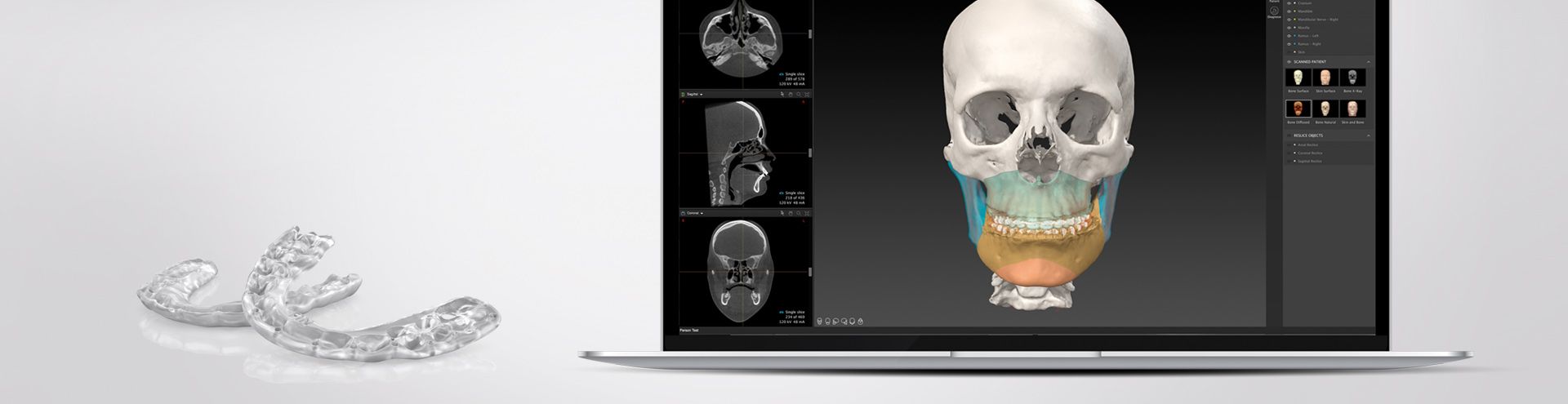 Tips, tricks and pitfalls  in advanced 3D virtual surgical planning