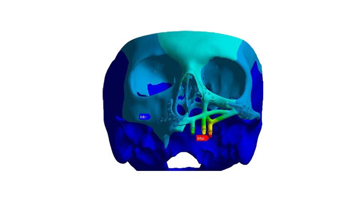 IPS inSilico® x VIT