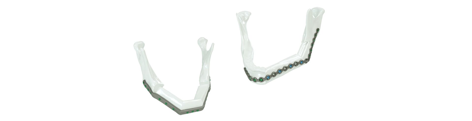 Sunderland Free Flap Course