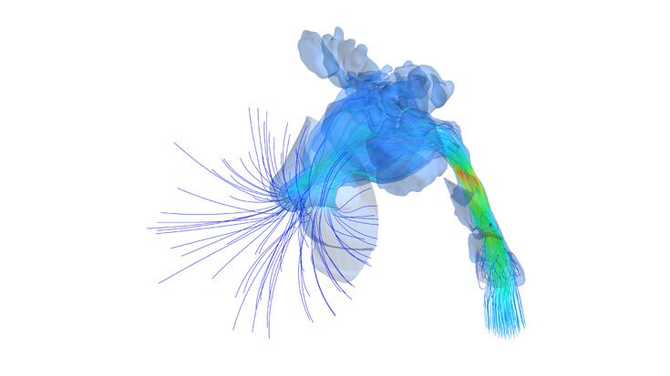 IPS inSilico® x OSA Video