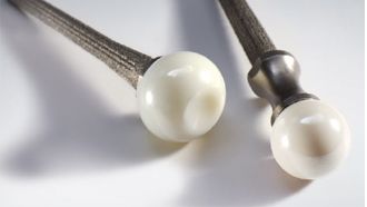 UHP – Ulnakopfprothese