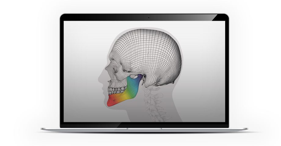 Individual Patient Solutions - IPS inSilico®
