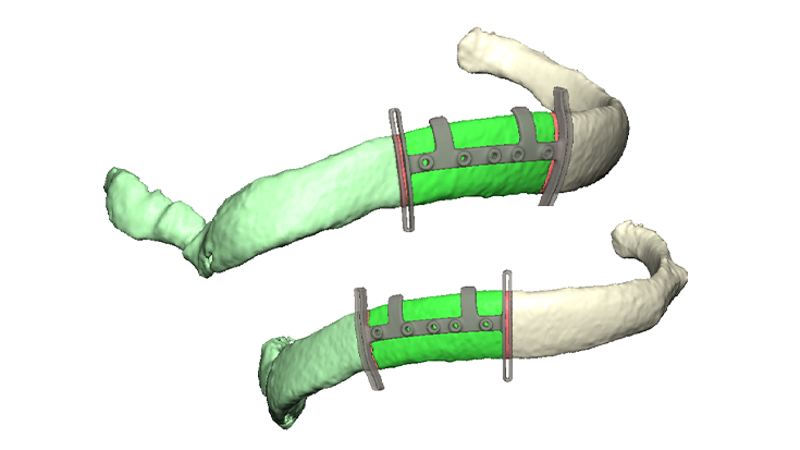 Fixation of the distractors