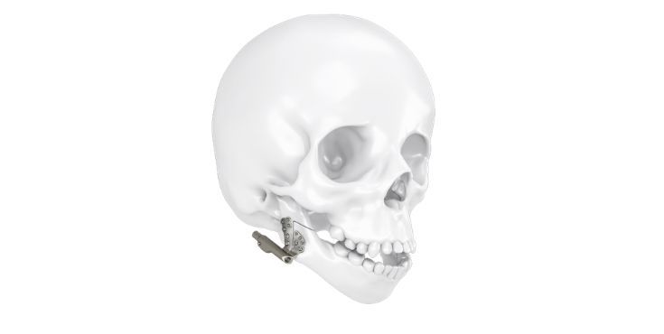 Mandible