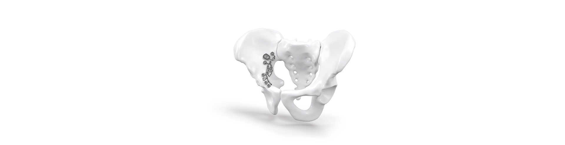 Kopfbild Nexos® Pelvis 