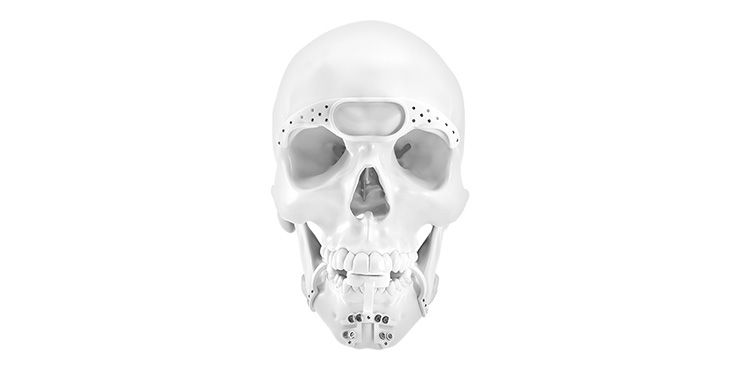 IPS Implants® Transformation