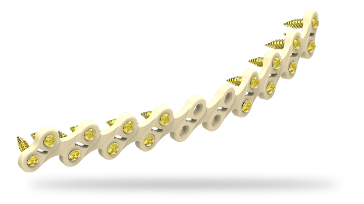 Resilient in dynamic conditions