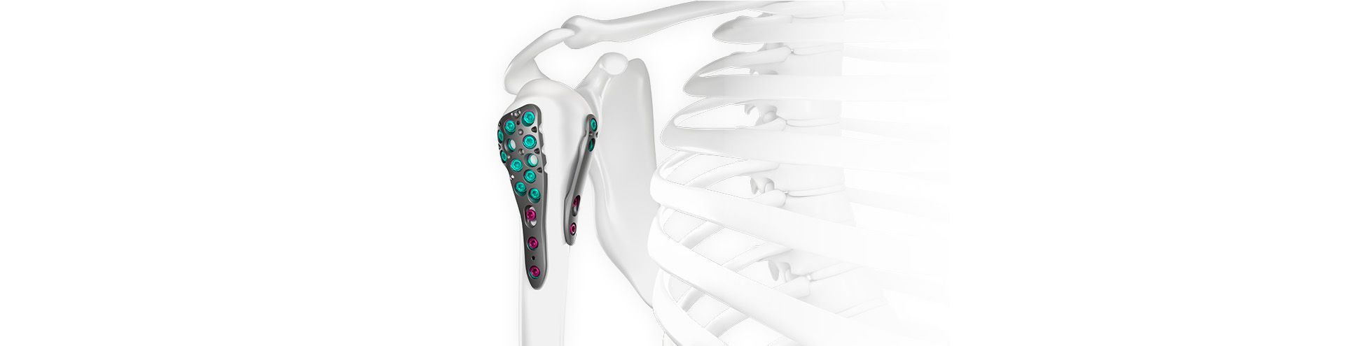 Kopfbild Nexos® Shoulder