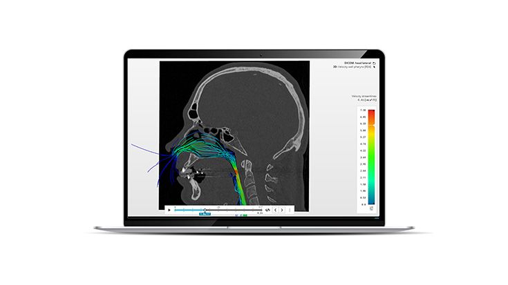 IPS inSilico® x OSA