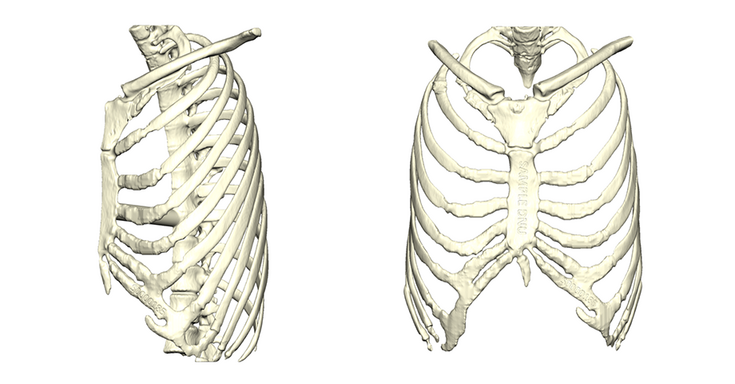 Optimal precision-fit