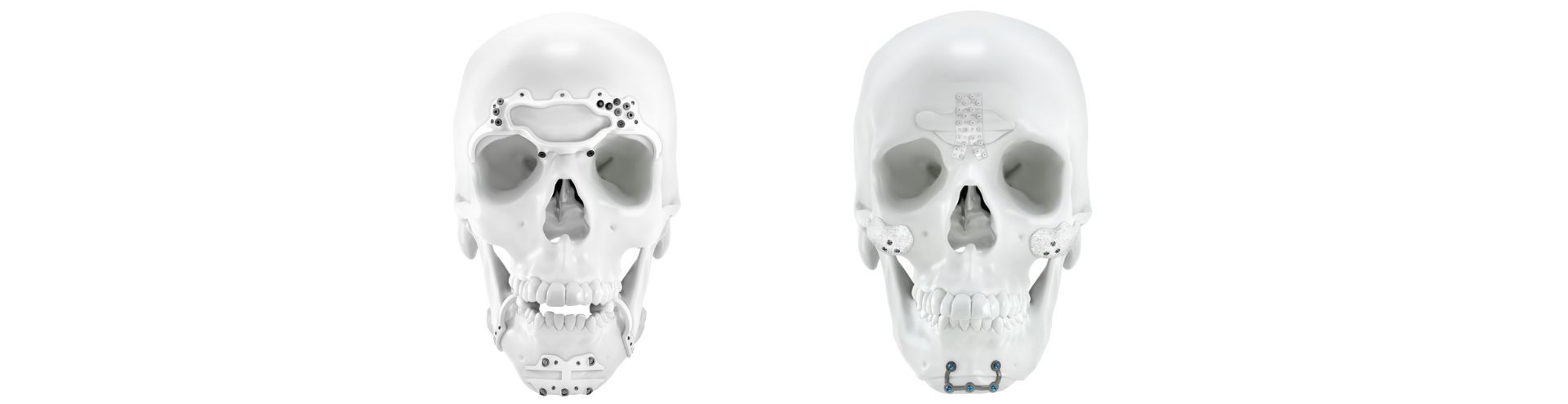 IPS® Clinical Masterclass on facial gender-affirming surgery