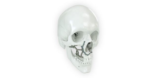 IPS Implants Preprosthetic